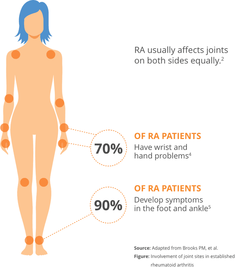 indication-disease-overview-otrexup-methotrexate-injection-for